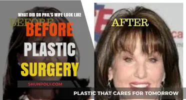 Dr. Phil's Wife: Unveiling Her Pre-Plastic Surgery Appearance