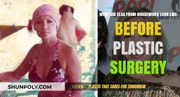 Elsa's Transformation: Unveiling Her Pre-Plastic Surgery Appearance on Housewives