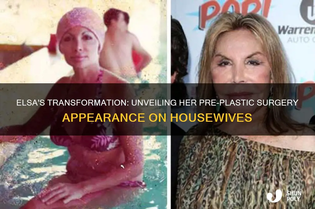 what did elsa from housewives look like before plastic surgery