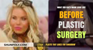 Unveiling Gio's Mom: Her Pre-Plastic Surgery Appearance Revealed