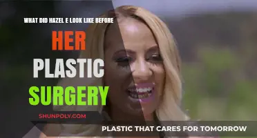 Hazel E's Pre-Surgery Transformation: Unveiling Her Original Look