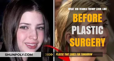 Ivanka Trump's Pre-Surgery Appearance: Unveiling Her Natural Look