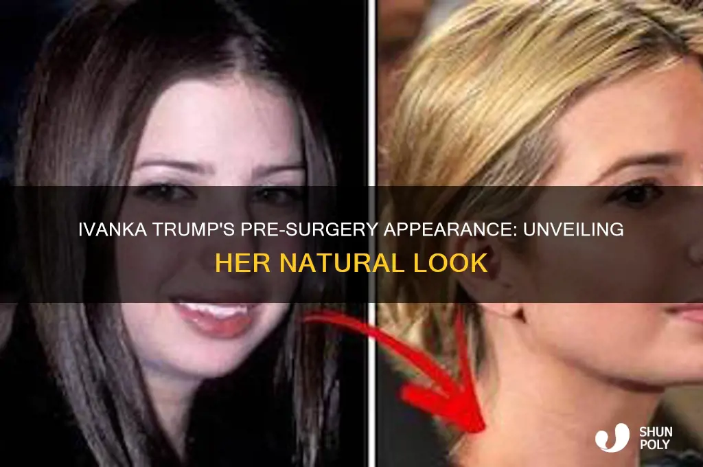 what did ivanka trump look like before plastic surgery