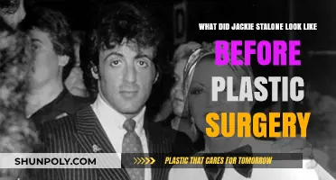 Jackie Stallone's Pre-Plastic Surgery Appearance: A Look Back