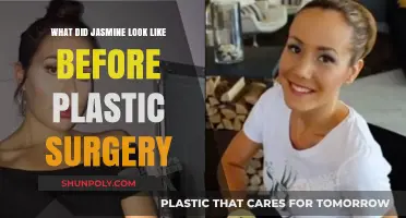 Jasmine's Pre-Surgery Appearance: Unveiling Her Natural Beauty Transformation