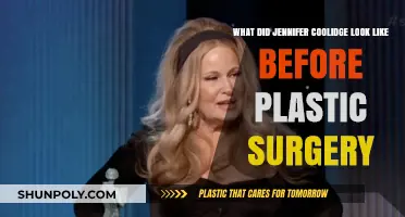 Jennifer Coolidge's Transformation: Pre-Plastic Surgery Look Revealed