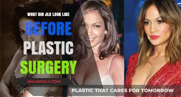 JLo's Transformation: Unveiling Her Pre-Plastic Surgery Appearance