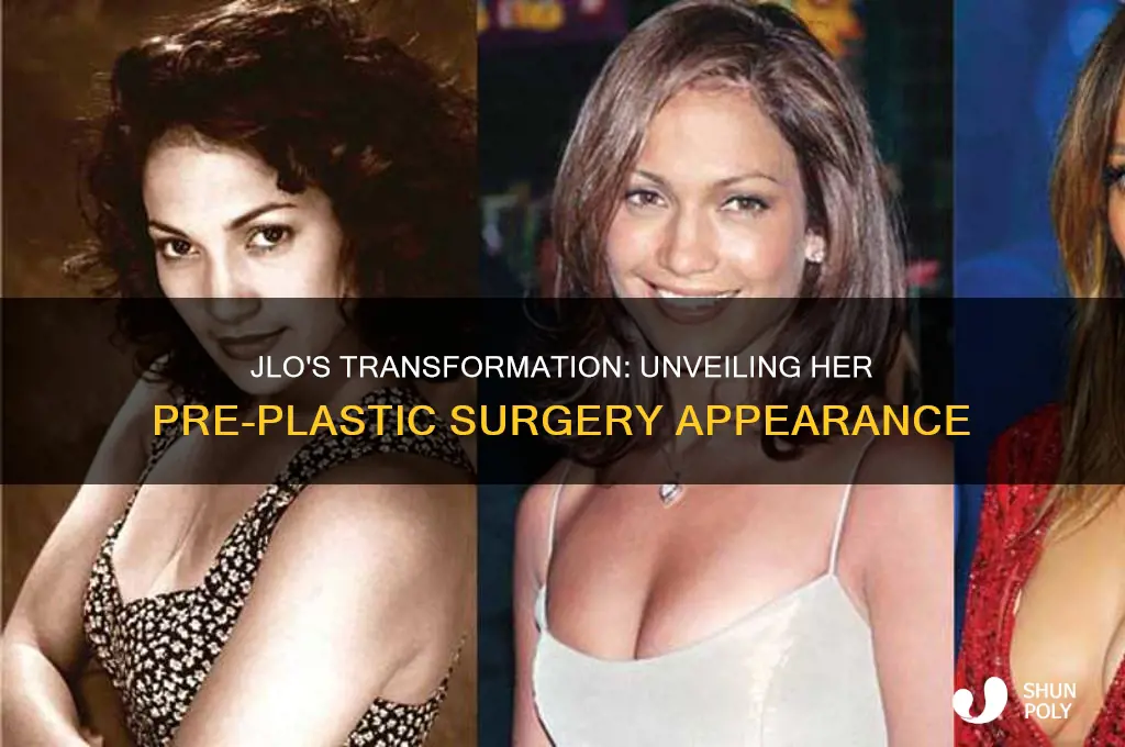 what did jlo look like before plastic surgery
