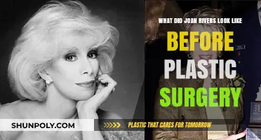 Joan Rivers' Pre-Surgery Appearance: Unveiling Her Natural Beauty Evolution