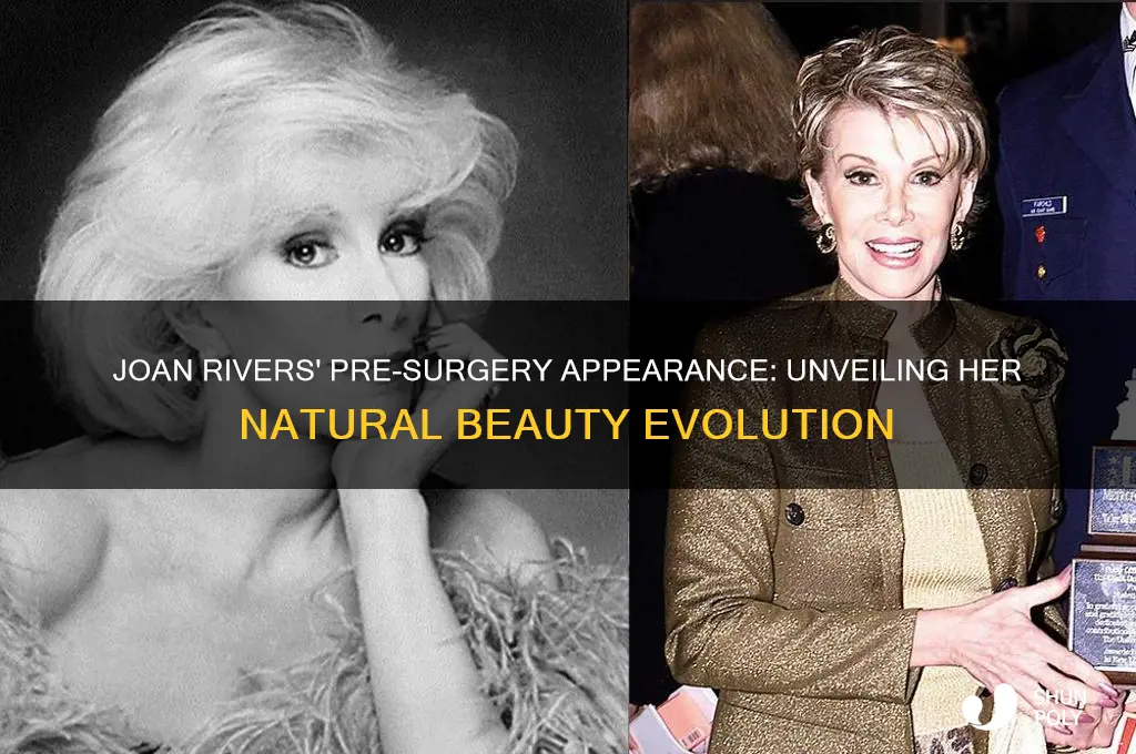 what did joan rivers look like before plastic surgery