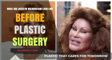 Jocelyn Wildenstein's Pre-Surgery Appearance: Unveiling Her Original Look