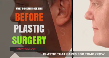 Unveiling Kane's Pre-Surgery Appearance: A Look Back at Their Transformation