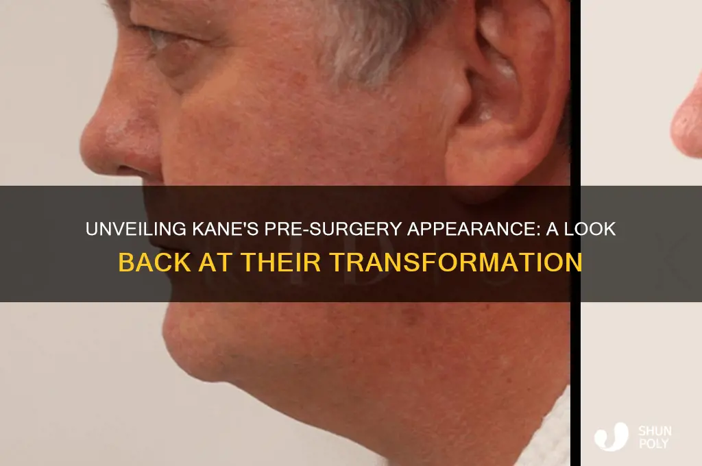 what did kane look like before plastic surgery