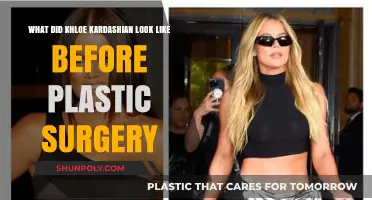 Khloe Kardashian's Transformation: Pre-Surgery Look Revealed