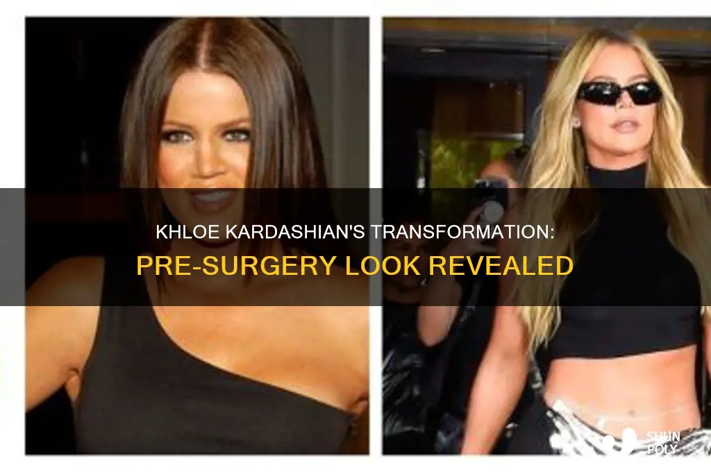 what did khloe kardashian look like before plastic surgery