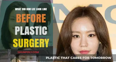 Kim Lee's Pre-Plastic Surgery Appearance: Unveiling Her Original Look