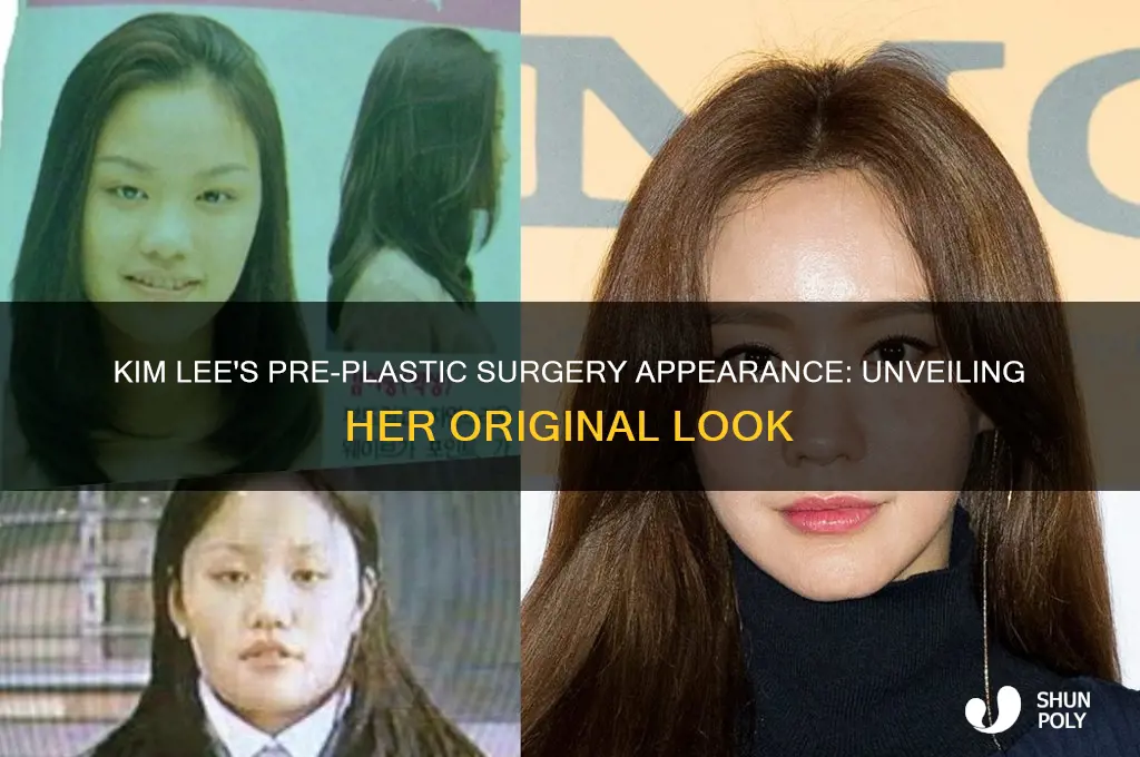 what did kim lee look like before plastic surgery