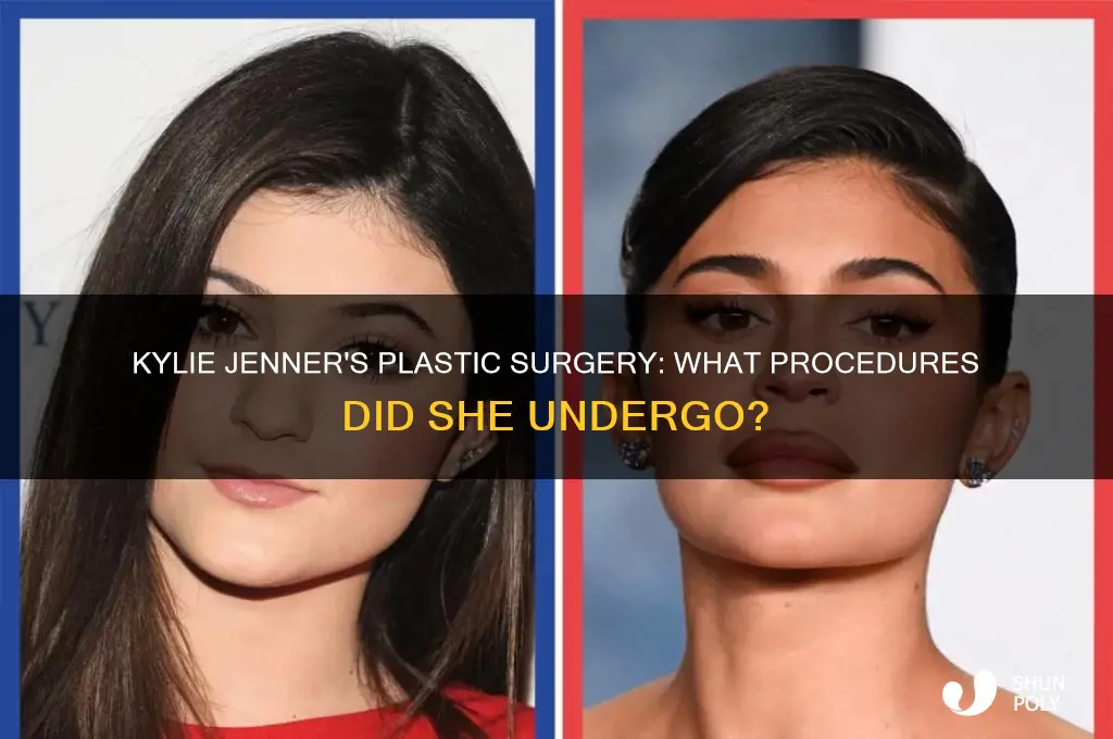 what did kylie jenner get plastic surgery on