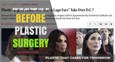 Lara Trump's Transformation: Pre-Plastic Surgery Appearance Revealed