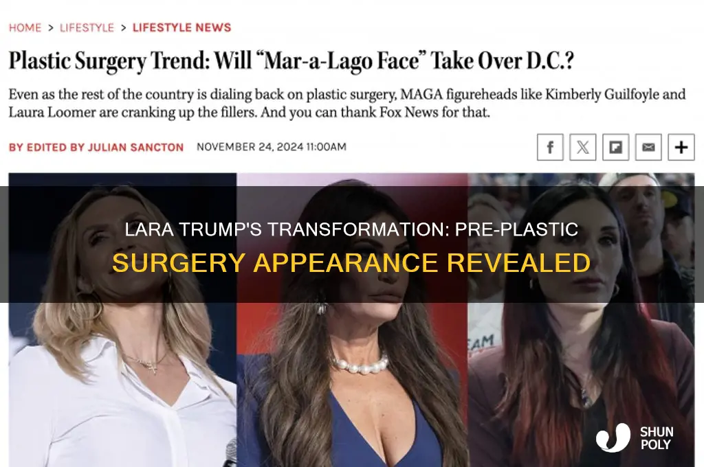 what did lara trump look like before plastic surgery