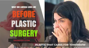 Larissa's Pre-Surgery Transformation: Unveiling Her Original Look