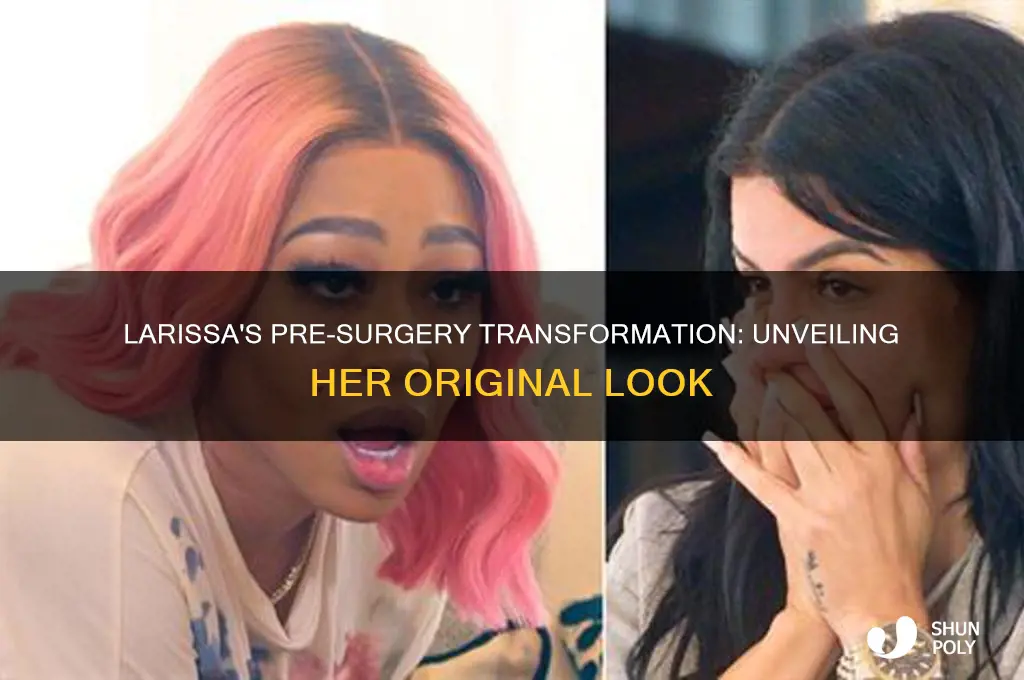what did larissa look like before plastic surgery