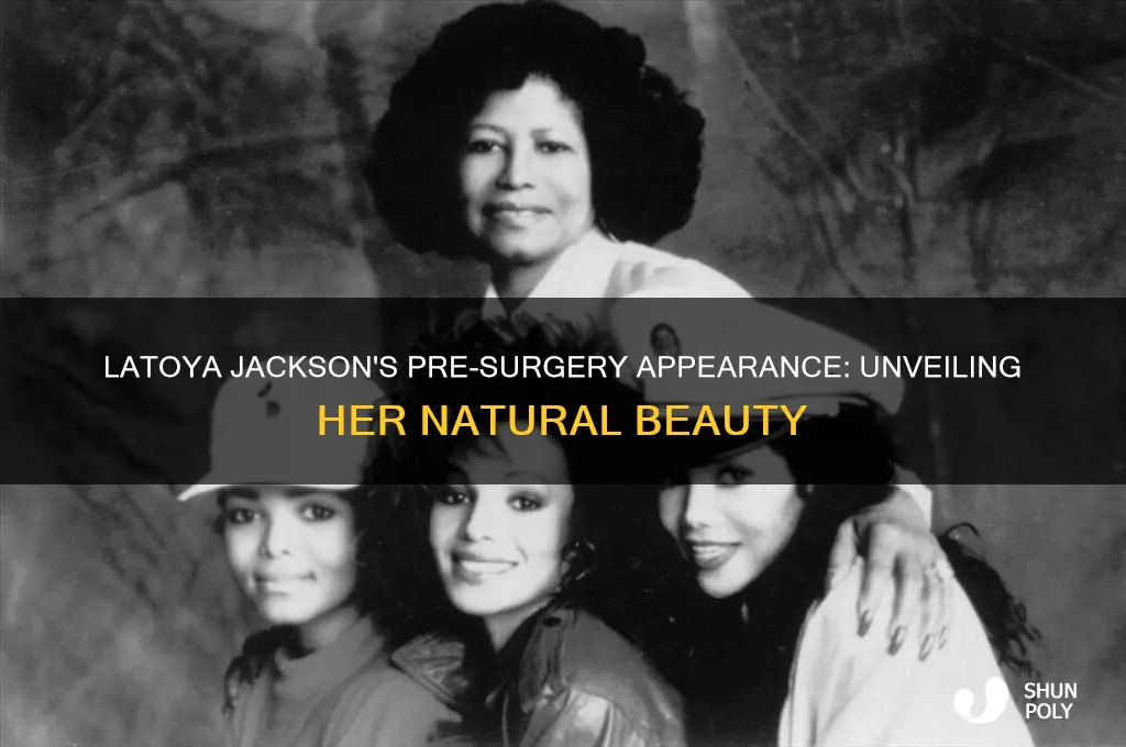 what did latoya jackson look like before plastic surgery