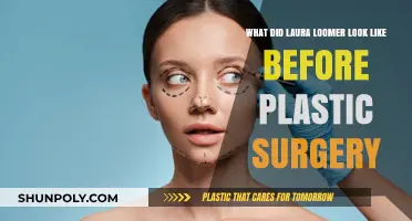Laura Loomer's Pre-Plastic Surgery Appearance: Unveiling Her Natural Look