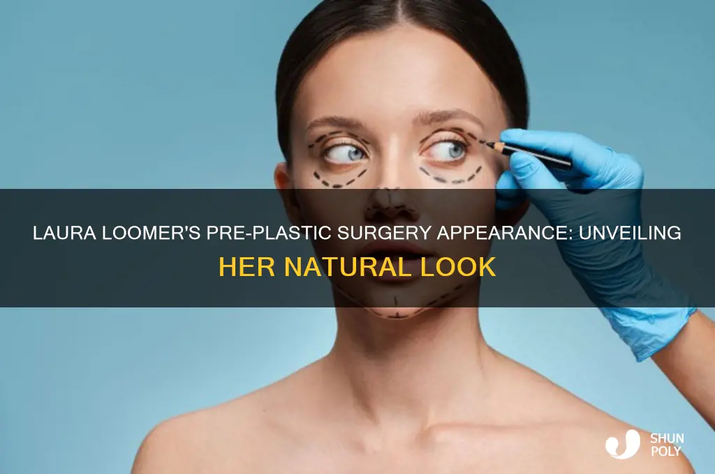 what did laura loomer look like before plastic surgery