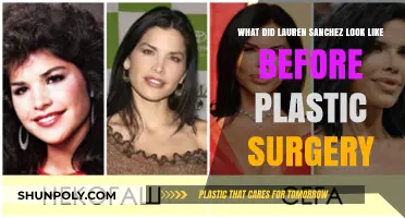 Lauren Sanchez's Transformation: Pre-Plastic Surgery Appearance Revealed