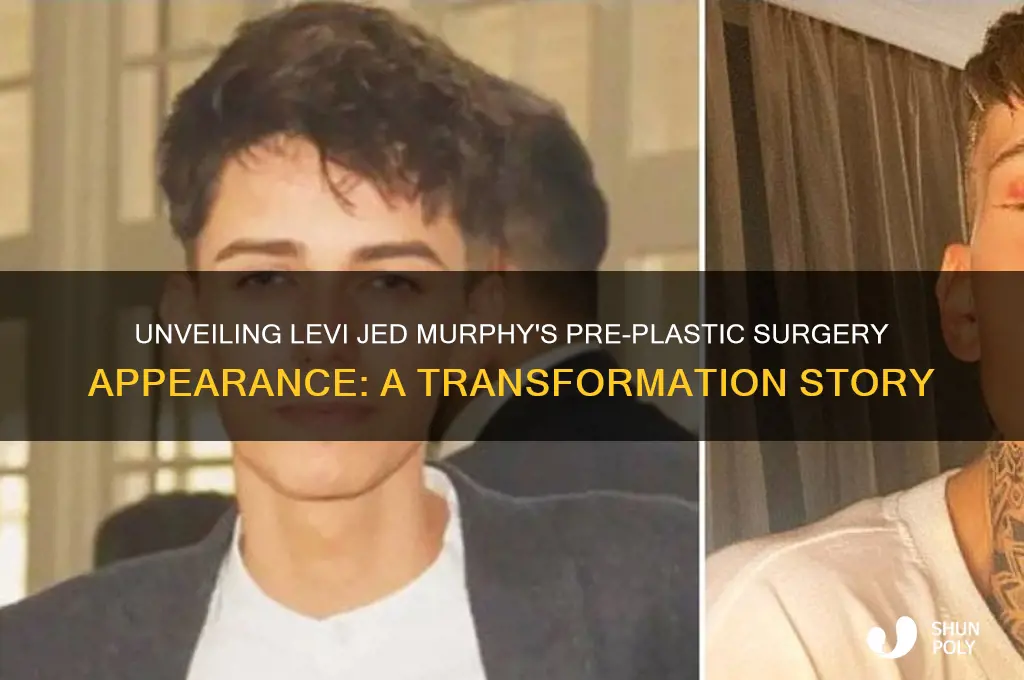 what did levi jed murphy look like before plastic surgery