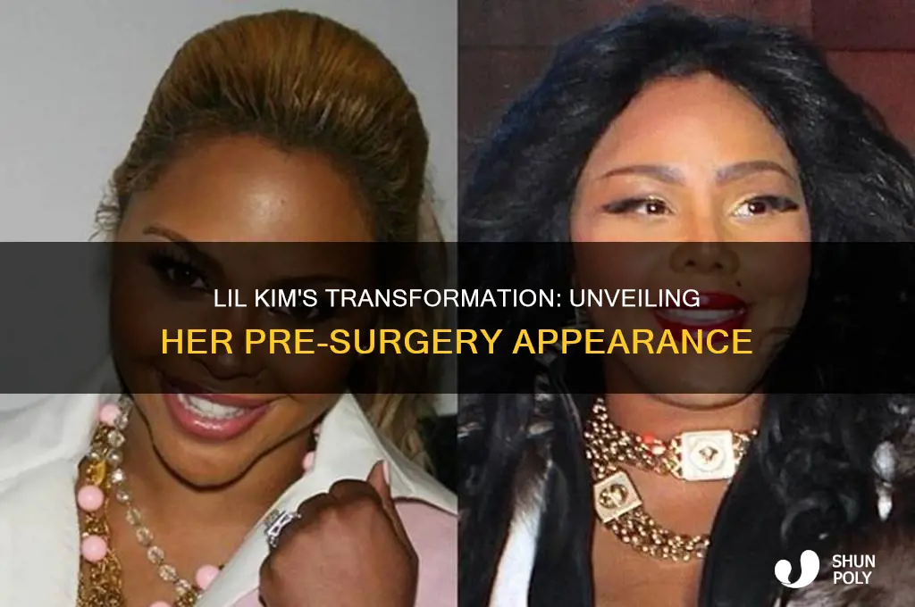 what did lil kim look like before plastic surgery