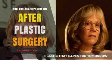 Linda Tripp's Post-Plastic Surgery Appearance: A Transformative Journey Revealed