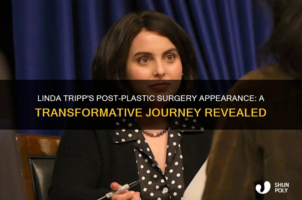 what did linda tripp look like after plastic surgery