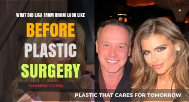 Lisa RHOM's Transformation: Unveiling Her Pre-Plastic Surgery Look
