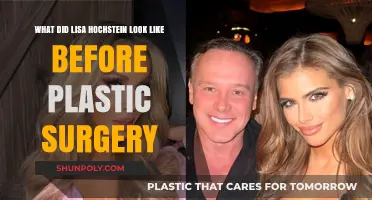 Lisa Hochstein's Pre-Plastic Surgery Look: Unveiling Her Natural Beauty