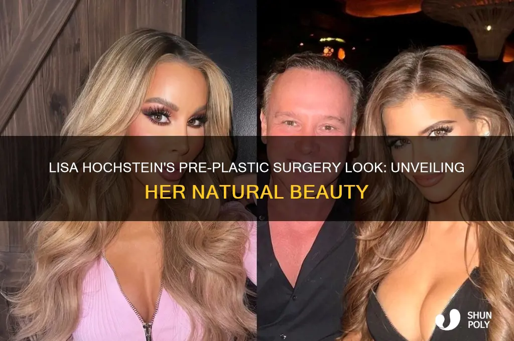 what did lisa hochstein look like before plastic surgery