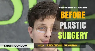 Matt Rife's Transformation: Unveiling His Pre-Surgery Appearance