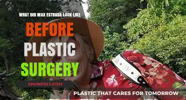Max Estrada's Pre-Surgery Appearance: Unveiling the Transformation Journey