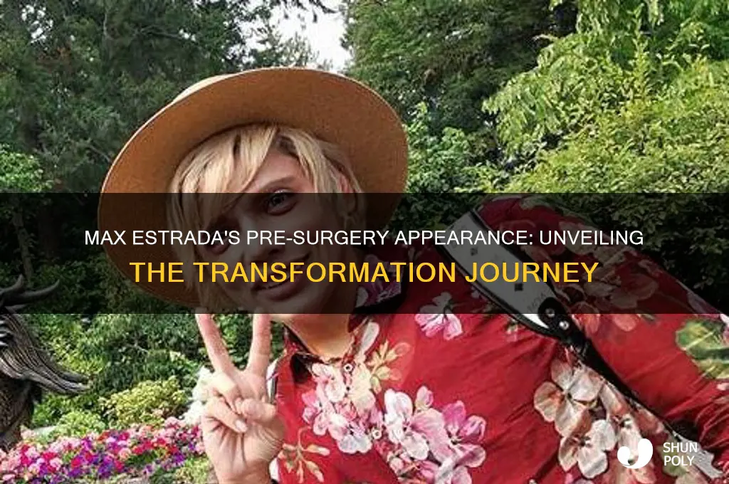 what did max estrada look like before plastic surgery
