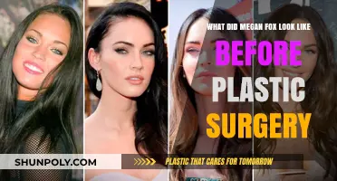 Megan Fox's Pre-Surgery Transformation: Unveiling Her Natural Beauty