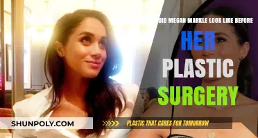 Megan Markle's Pre-Surgery Appearance: Unveiling Her Natural Beauty Evolution
