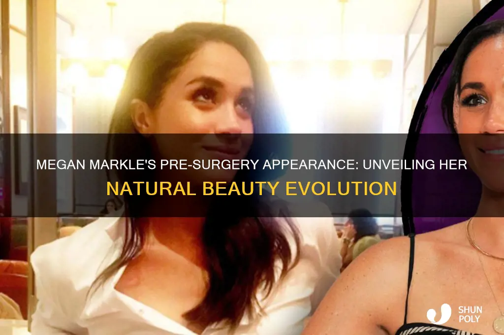 what did megan markle look like before her plastic surgery