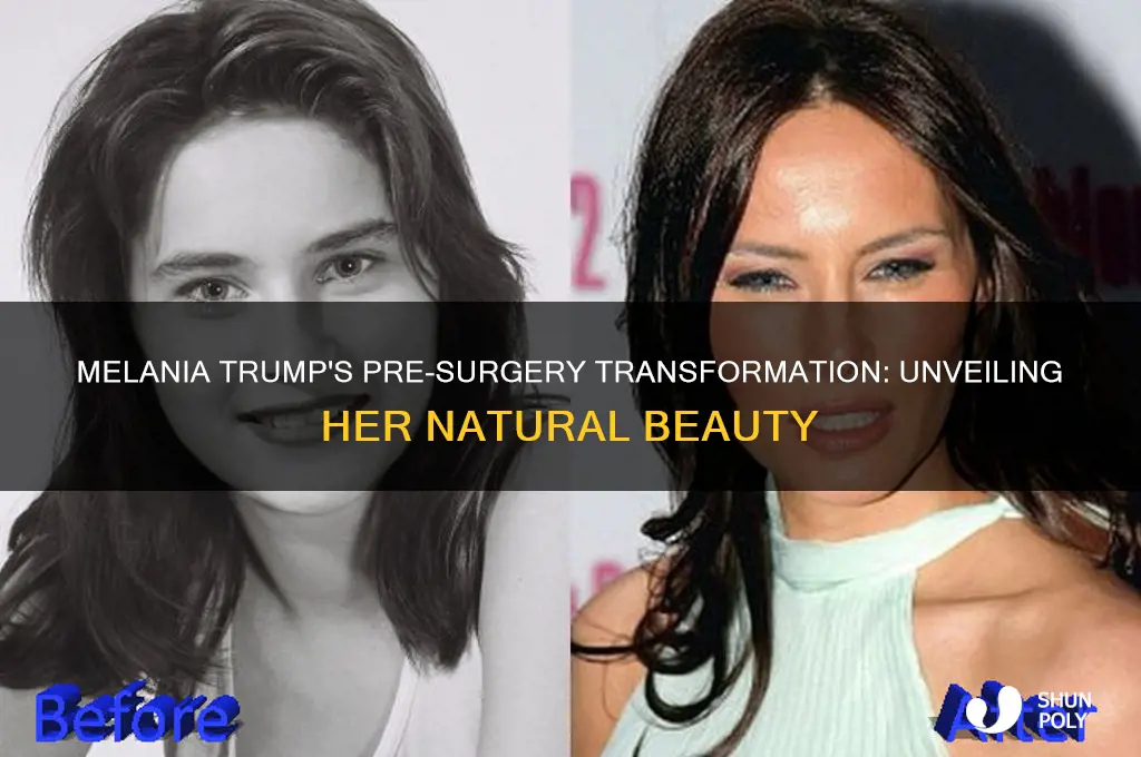 what did melania trump look like before plastic surgery