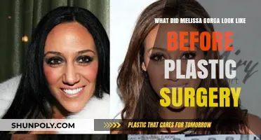 Melissa Gorga's Transformation: Unveiling Her Pre-Plastic Surgery Look