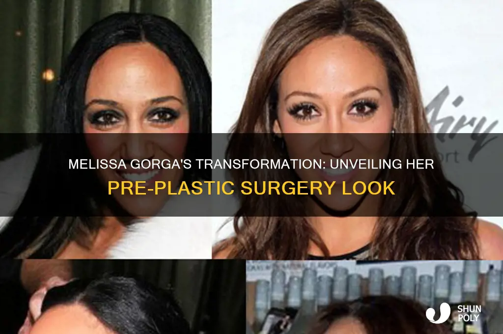what did melissa gorga look like before plastic surgery