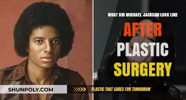 Michael Jackson's Transformed Appearance: Post-Plastic Surgery Revelations