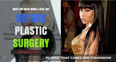 Nicki Minaj's Transformation: Unveiling Her Pre-Surgery Appearance