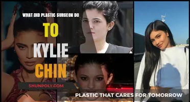 Kylie Jenner's Chin Transformation: Plastic Surgery Secrets Revealed