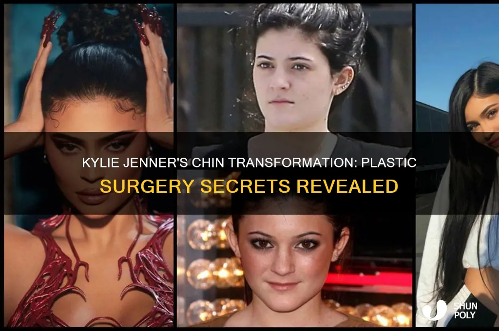 what did plastic surgeon do to kylie chin